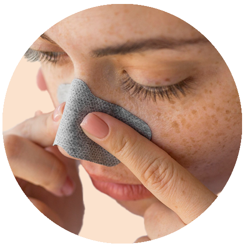 Blackheads