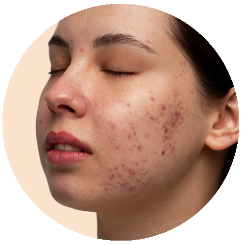Dark spots