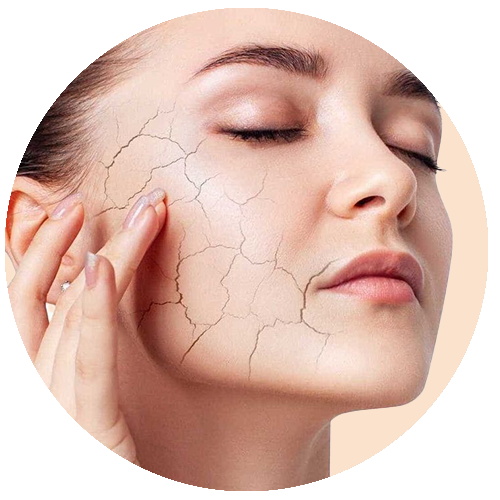 Dry Skin