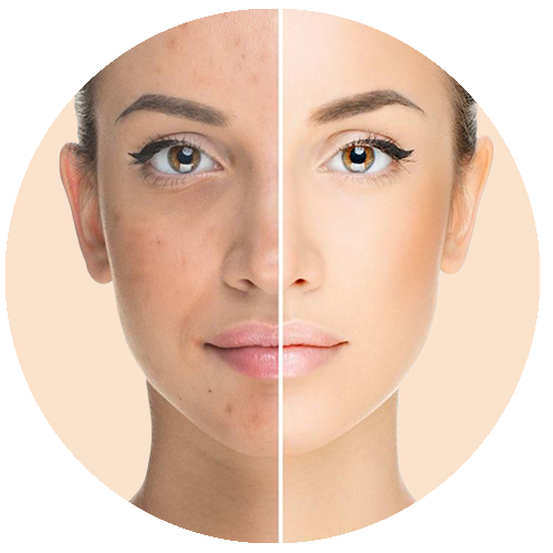 Pollution-damaged skin