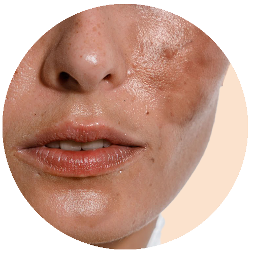 Uneven texture